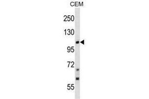 TRPC7 Antibody (C-term) western blot analysis in CEM cell line lysates (35 µg/lane). (TRPC7 抗体  (C-Term))