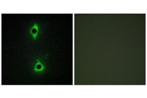 Immunofluorescence (IF) image for anti-phosphoinositide Kinase, FYVE Finger Containing (PIKFYVE) (N-Term) antibody (ABIN1850108) (PIKFYVE 抗体  (N-Term))