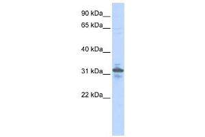 Western Blotting (WB) image for anti-Ribose 5-Phosphate Isomerase A (RPIA) antibody (ABIN2459906) (Ribose 5-Phosphate Isomerase A (RPIA) 抗体)