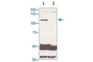 5 mg of the whole cell lysate derived from conditioned LNCaP were immunoprecipitated by 4 ug of Phospho-AR S210 polyclonal antibody (Cat # PAB12654, lane 1) or pre adsorbed by immunization peptide (lane 2) followed by AR polyclonal antibody  at 1 : 500. (Androgen Receptor 抗体  (N-Term))