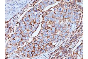 Formalin-fixed, paraffin-embedded human Breast tissue stained with CD44 Mouse Monoclonal Antibody (DF1485). (CD44 抗体)