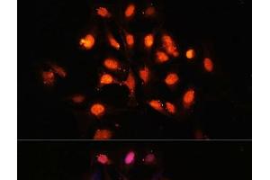 Immunofluorescence analysis of U-2 OS cells using PHLPP1 Polyclonal Antibody at dilution of 1:100 (40x lens). (PHLPP1 抗体)