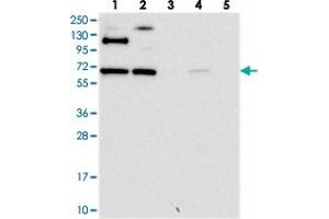 Western blot analysis of Lane 1: RT-4, Lane 2: U-251 MG, Lane 3: Human Plasma, Lane 4: Liver, Lane 5: Tonsil with RUFY2 polyclonal antibody  at 1:250-1:500 dilution. (RUFY2 抗体)