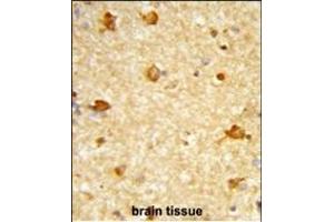 Formalin-fixed and paraffin-embedded human brain tissue reacted with DIRAS1 Antibody (Center), which was peroxidase-conjugated to the secondary antibody, followed by DAB staining. (DIRAS1 抗体  (AA 109-136))