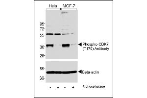 Western blot analysis of extracts from Hela and MCF-7 cells, untreated or lamda phosphatase-treated, using Phospho-CDK7 Antibody (upper) or Beta-actin (lower). (CDK7 抗体  (pThr170))