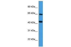 COL8A2 antibody used at 0. (COL8a2 抗体  (Middle Region))