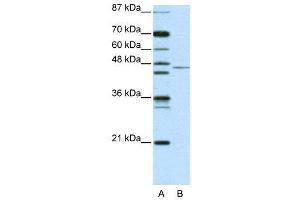 WB Suggested Anti-TRIM14 AntibodyTitration: 2. (TRIM14 抗体  (N-Term))