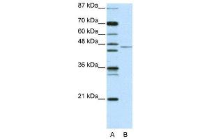 WB Suggested Anti-TRIM14 AntibodyTitration: 2. (TRIM14 抗体  (N-Term))