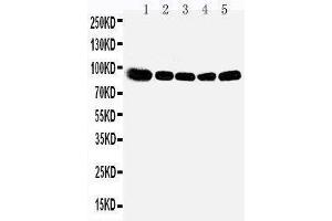 Anti-OSBP1 antibody, Western blotting Lane 1: Rat Kidney Tissue Lysate Lane 2: Rat Spleen Tissue Lysate Lane 3: Rat Lung Tissue Lysate Lane 4: HELA Cell Lysate Lane 5: A549 Cell Lysate (OSBP 抗体  (Middle Region))