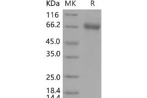 EPHA1 Protein (His tag)