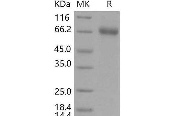 EPHA1 Protein (His tag)