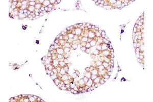 Immunohistochemistry of paraffin-embedded rat testis using Clathrin heavy chain Rabbit mAb (ABIN7266404) at dilution of 1:100 (40x lens). (Clathrin Heavy Chain (CLTC) 抗体)