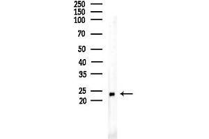 Western blot analysis of lysates from F10-LUC cells(UV,30 min treatment), using MOA Antibody at 1/1000 dilution.