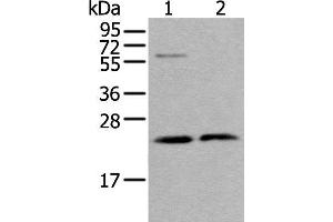 Western blot analysis of LO2 cell and Human testis tissue lysates using ABHD14B Polyclonal Antibody at dilution of 1:350 (ABHD14B 抗体)