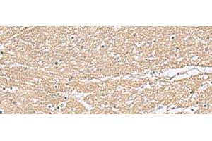 Immunohistochemistry of paraffin-embedded Human brain tissue using KCTD7 Polyclonal Antibody at dilution of 1:55(x200) (KCTD7 抗体)
