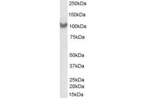 Image no. 2 for anti-Proteasome (Prosome, Macropain) 26S Subunit, Non-ATPase, 2 (PSMD2) (C-Term) antibody (ABIN185319)