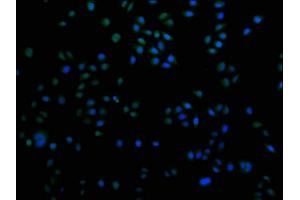 Immunofluorescence staining of Hela cells with ABIN7155485 at 1:100, counter-stained with DAPI. (SUV420H2/KMT5C 抗体  (AA 235-345))