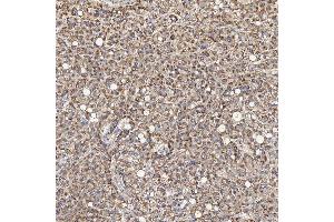 IHC analysis of ACAD9 using anti-ACAD9 antibody (ABIN7602670).