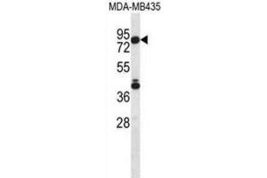 Western Blotting (WB) image for anti-Sphingosine-1-Phosphate Lyase 1 (SGPL1) antibody (ABIN2996917) (SGPL1 抗体)