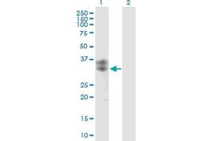 Western Blot analysis of CLEC5A expression in transfected 293T cell line by CLEC5A MaxPab polyclonal antibody. (CLEC5A 抗体  (AA 1-188))