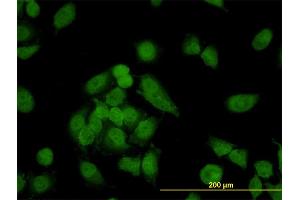 Immunofluorescence of monoclonal antibody to CNAP1 on HeLa cell. (NCAPD2 抗体  (AA 1240-1339))
