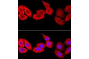 Confocal immunofluorescence analysis of U-2 OS cells using S100 Polyclonal Antibody (ABIN7270129) at dilution of 1:100. (S100A8 抗体  (AA 1-93))