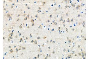 ABIN6265813 and ABIN6272621 at 1/100 staining Rat brain tissue by IHC-P. (TXK 抗体  (N-Term))