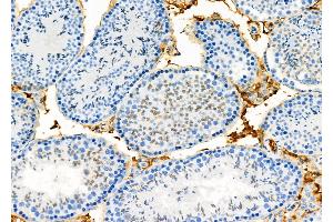 ABIN6265772 and ABIN6273336 at 1/100 staining Mouse testis tissue by IHC-P. (TSH receptor 抗体  (Internal Region))