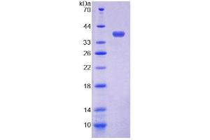 SDS-PAGE analysis of Horse ECF Protein. (ECF 蛋白)