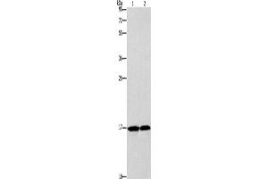 Western Blotting (WB) image for anti-Glia Maturation Factor, gamma (GMFG) antibody (ABIN2422817) (GMFG 抗体)