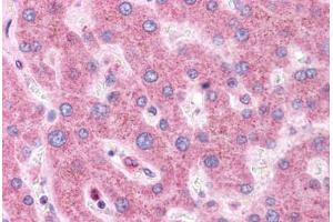 Human Liver: Formalin-Fixed, Paraffin-Embedded (FFPE) (HNF1A 抗体  (AA 179-228))