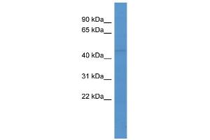 Western Blotting (WB) image for anti-Ligand Dependent Nuclear Receptor Corepressor (Lcor) (C-Term) antibody (ABIN2774271)