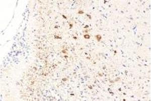 Immunohistochemistry analysis of paraffin-embedded rat brain using RASGRP3 (ABIN7075376) at dilution of 1: 1000