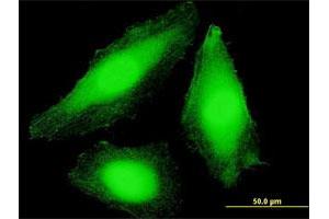 Immunofluorescence of purified MaxPab antibody to COPS7B on HeLa cell. (COPS7B 抗体  (AA 1-264))