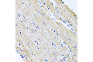 Immunohistochemistry of paraffin-embedded mouse heart using ABCB8 antibody. (ABCB8 抗体)