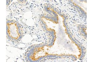 ABIN6264578 and ABIN6272979 at 1/100 staining Human normal tissues adjacent to breast cancer by IHC-P. (RAB3D 抗体  (Internal Region))