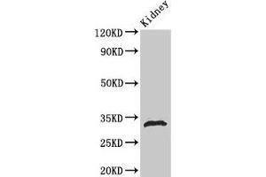 Western Blot Positive WB detected in: Rat kidney tissue All lanes: HIST1H1B antibody at 1 μg/mL Secondary Goat polyclonal to rabbit IgG at 1/50000 dilution Predicted band size: 23 kDa Observed band size: 32 kDa (Histone H1.5 抗体  (pSer188))