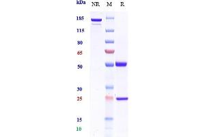 Anti-CSF2 / GM-CSF Reference Antibody (namilumab) on SDS-PAGE under reducing (R) condition. (Recombinant CSF2 (Namilumab Biosimilar) 抗体)