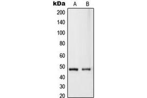 Western blot analysis of RASSF8 expression in HeLa (A), MCF7 (B) whole cell lysates. (RASSF8 抗体  (Center))