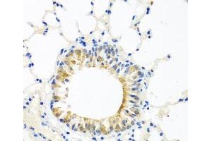 Immunohistochemistry of paraffin-embedded Mouse lung using COQ7 Polyclonal Antibody at dilution of 1:100 (40x lens). (Coq7 抗体)