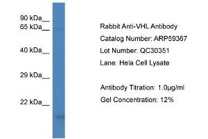 Western Blotting (WB) image for anti-Von Hippel-Lindau Tumor Suppressor, E3 Ubiquitin Protein Ligase (VHL) (N-Term) antibody (ABIN2788043) (VHL 抗体  (N-Term))