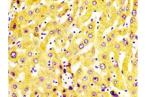 Immunohistochemistry (IHC) image for anti-Cytochrome P450, Family 2, Subfamily C, Polypeptide 19 (CYP2C19) (AA 245-353) antibody (ABIN7149243)