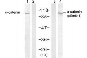 Western blot analysis of extract from A431 cells untreated or treated with EGF (200ng/ml, 30min), using α-catenin (Ab-641) antibody (E021330, Lane 1 and 2) and α-catenin (Phospho-Ser641) antibody (E011330, Lane 3 and 4). (CTNNA1 抗体)