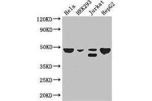 Western Blot Positive WB detected in: Hela whole cell lysate, HEK293 whole cell lysate, Jurkat whole cell lysate, HepG2 whole cell lysate All lanes: PLIN3 antibody at 3 μg/mL Secondary Goat polyclonal to rabbit IgG at 1/50000 dilution Predicted band size: 48, 29, 47, 46 kDa Observed band size: 48, 46 kDa (PLIN3 抗体  (AA 192-324))