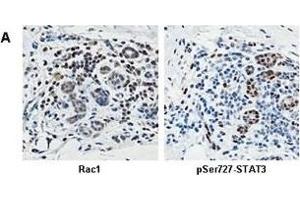 Immunohistochemistry (IHC) image for anti-RAC1 (Center) antibody (ABIN2854858)