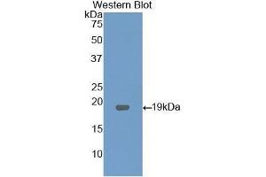 Western Blotting (WB) image for anti-Lysophosphatidylcholine Acyltransferase 3 (LPCAT3) (AA 122-233) antibody (ABIN1176546) (LPCAT3 抗体  (AA 122-233))