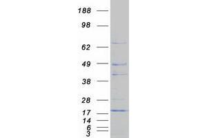 Western Blotting (WB) image for CDGSH Iron Sulfur Domain 1 (CISD1) protein (Myc-DYKDDDDK Tag) (ABIN2714196)