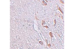 Immunohistochemistry (IHC) image for anti-Leucine Rich Repeat Transmembrane Neuronal 1 (LRRTM1) (C-Term) antibody (ABIN1030496) (LRRTM1 抗体  (C-Term))