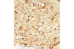 Image no. 1 for anti-serine/threonine Kinase 4 (STK4) (C-Term) antibody (ABIN360312) (STK4 抗体  (C-Term))