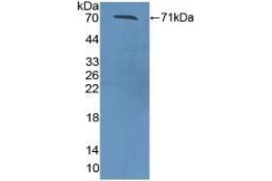 Western Blotting (WB) image for anti-serpin Peptidase Inhibitor, Clade A (Alpha-1 Antiproteinase, Antitrypsin), Member 10 (SERPINA10) (AA 22-448) antibody (ABIN7434530)